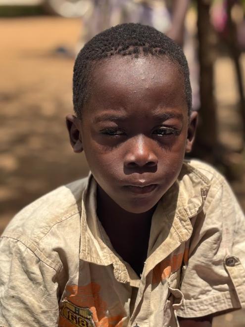 Shadrach, age 5, at Mark of Hope International in Uganda